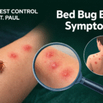 bed bug removal
